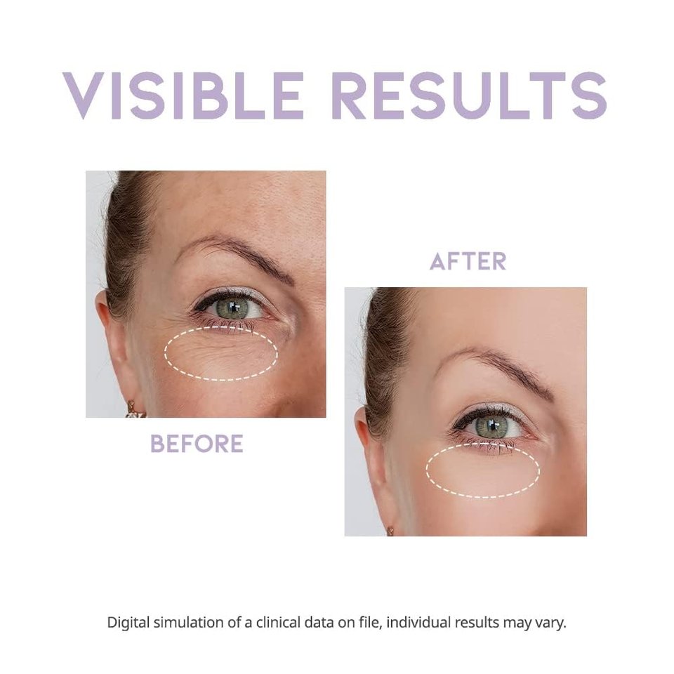 OOTD Overnight Eye Cream (25g) - K Beauty On